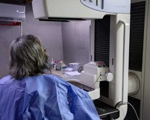 Una mujer de espaldas y frente a ella un mastógrafo.