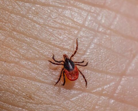 mortalidad en casos de rickettsia